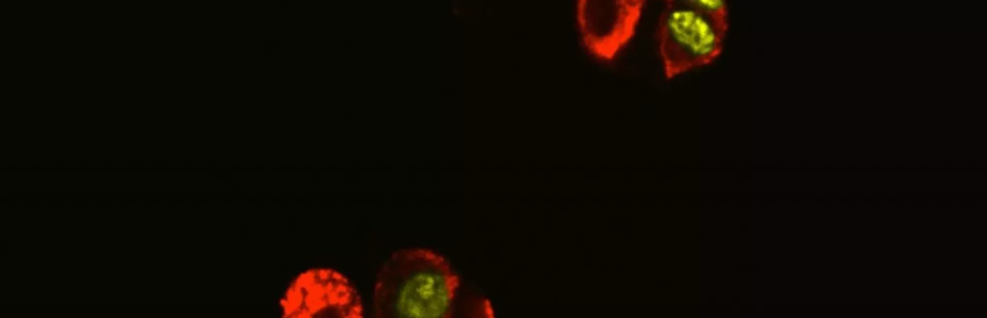 Compounds spur insulin-producing cells to replicate in the lab